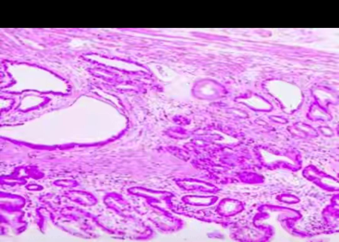 4次胃镜漏诊胃癌！医生戳破真相：不是检查没用，是你没选对方式！真的吓出一身