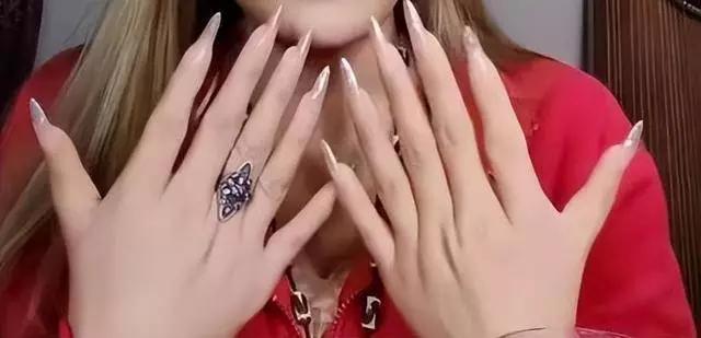 宿州女子天生双手共12根手指，家中姐弟多人是“六指”，医生解读“这不是AI