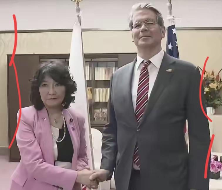 大家误会美财长贝森特了，他这站姿不是傲慢，是一种罕见的脊柱炎，西医很难治，他在美