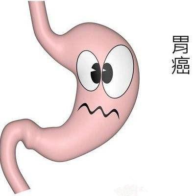 以下症状有1个就赶紧去医院, 小心胃癌! 做好3点胃癌绕着走