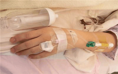 小儿推拿众道妙方——女性关怀: 剖腹产后用镇痛泵 会影响母乳吗