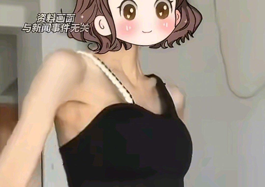 浙江一名23岁的女孩最近让很多医生都感到痛心。她身高1米7，原本110斤的体重在