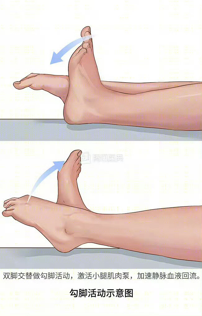 62岁阿姨返程堵车久坐19小时进ICU你们看，这就是为啥反反复复科普勾脚运动！非