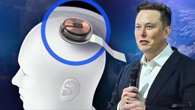 马斯克以后有可能掌控全球。当他的脑机接口技术成熟，很多人都会植入芯片，有些不