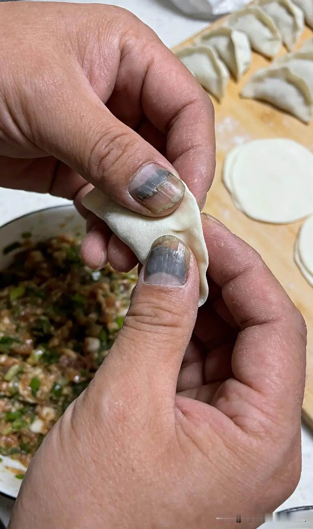 得了灰指甲，一个传染俩，中国人都知道的广告。浙江一男子到饭店吃饭，结完账以后