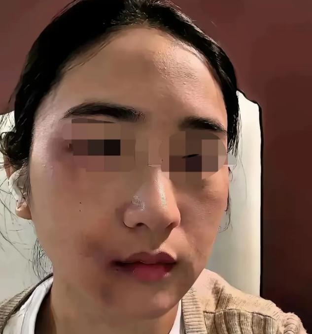 丈夫家暴妻子近10年，3天前还对她拳脚相向，转眼却被确诊为肝癌晚期。面对婆家要求