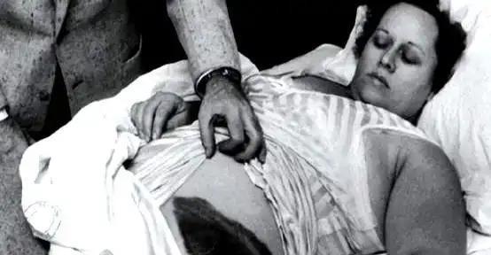 1954年，国外一女子正在睡觉中，突然感觉腹部和大腿被什么东西蹭着了一样，疼痛难