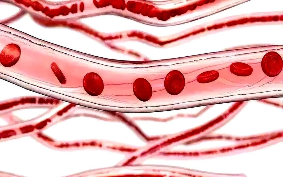 我求求你们了，别再信什么三七丹参能把血管“洗干净”了。那玩意儿堵在血管里，硬得