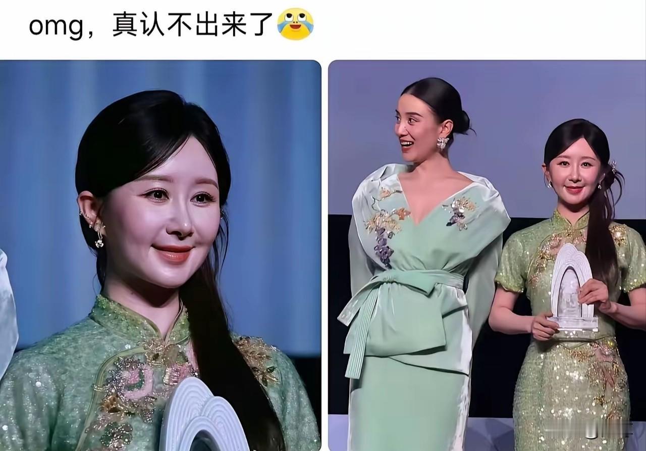 整容综合征，刚整容时确实好看，但年龄一大，时间一长就暴露出来了，不是丑了，是吓人