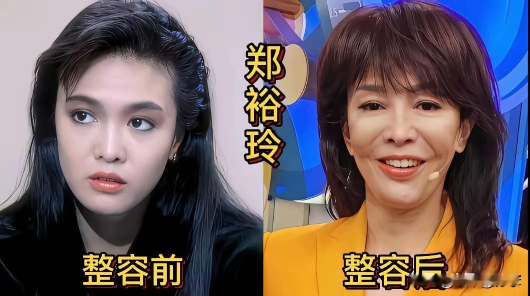 这能够大大方方承认自己整容的，其实也是一种有勇气的表现呀！我觉得熊黛林整容整的