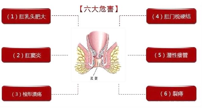 肛裂患者饮食至关重要