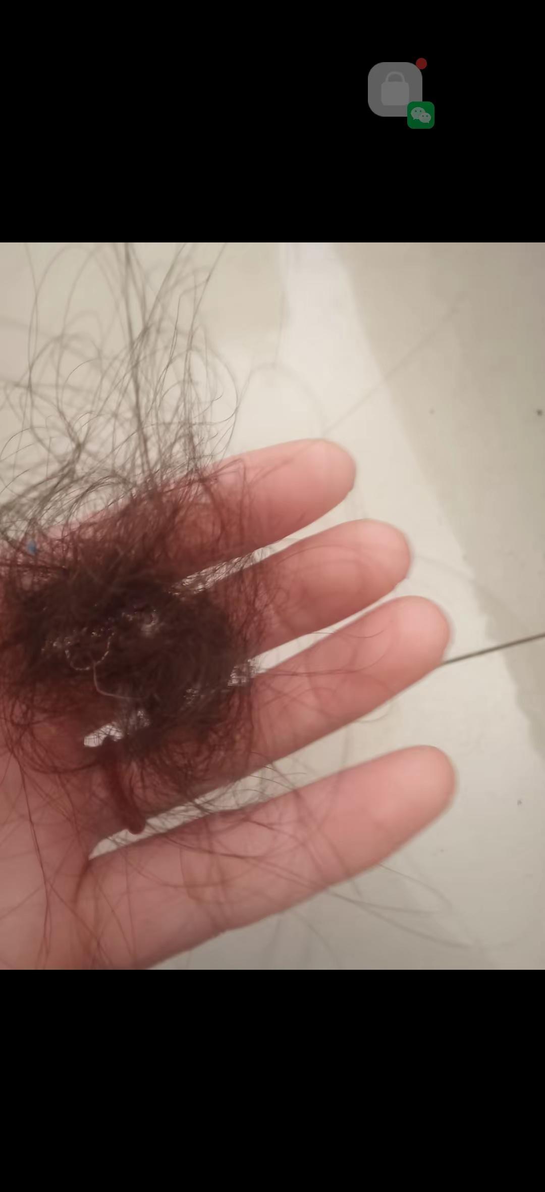 别再洗头了，洗不出头发来。你不是头发少，是毛囊快睡死了。洗发水、生物素，当零