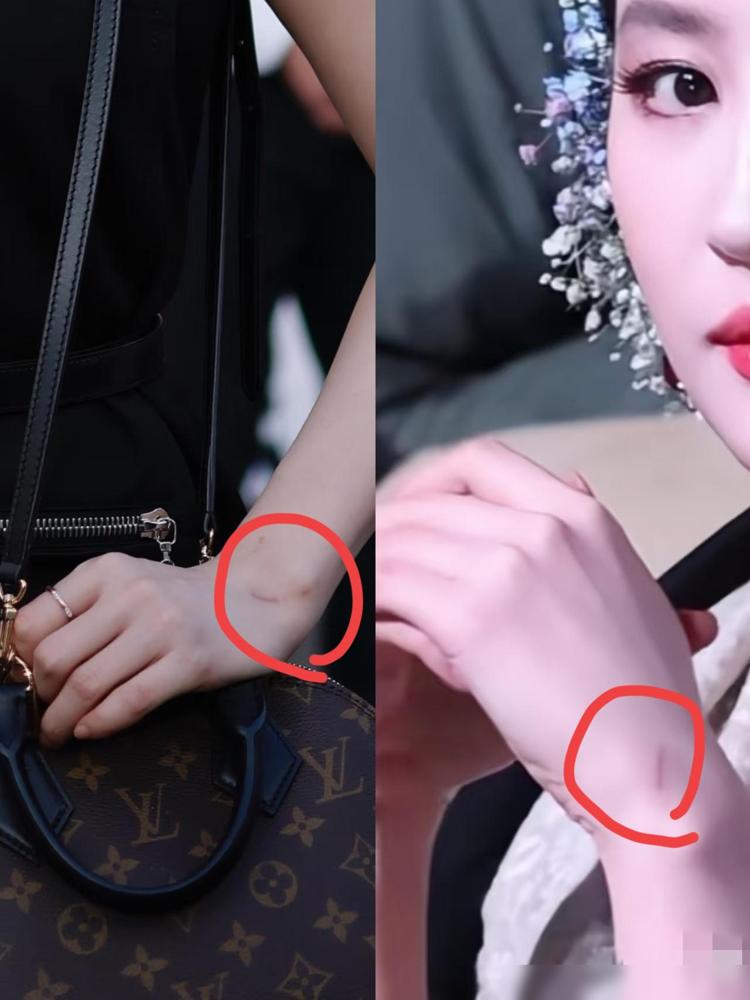 看出来了吗？就算是刘亦菲也逃不过，从图片里就能看出来，刘亦菲的手上都是抓