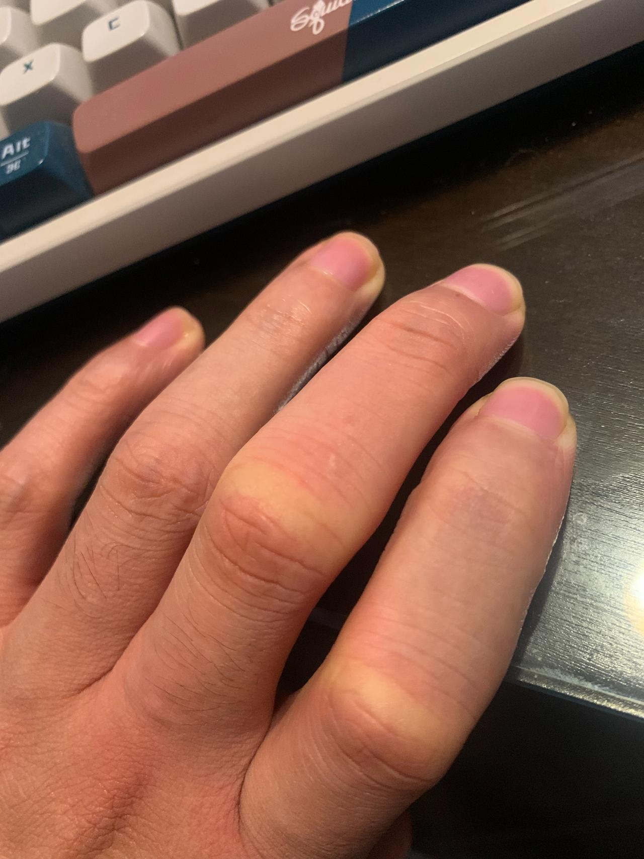 去村里参加葬礼，看院子里的大红枣就挂在头顶，手贱想摘一个，手指刚一碰到枣，手指背