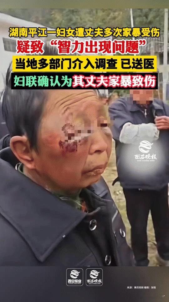 湖南平江一妇女遭家暴疑似智力受影响，这事看得人揪心！湖南平江一妇女被丈夫多