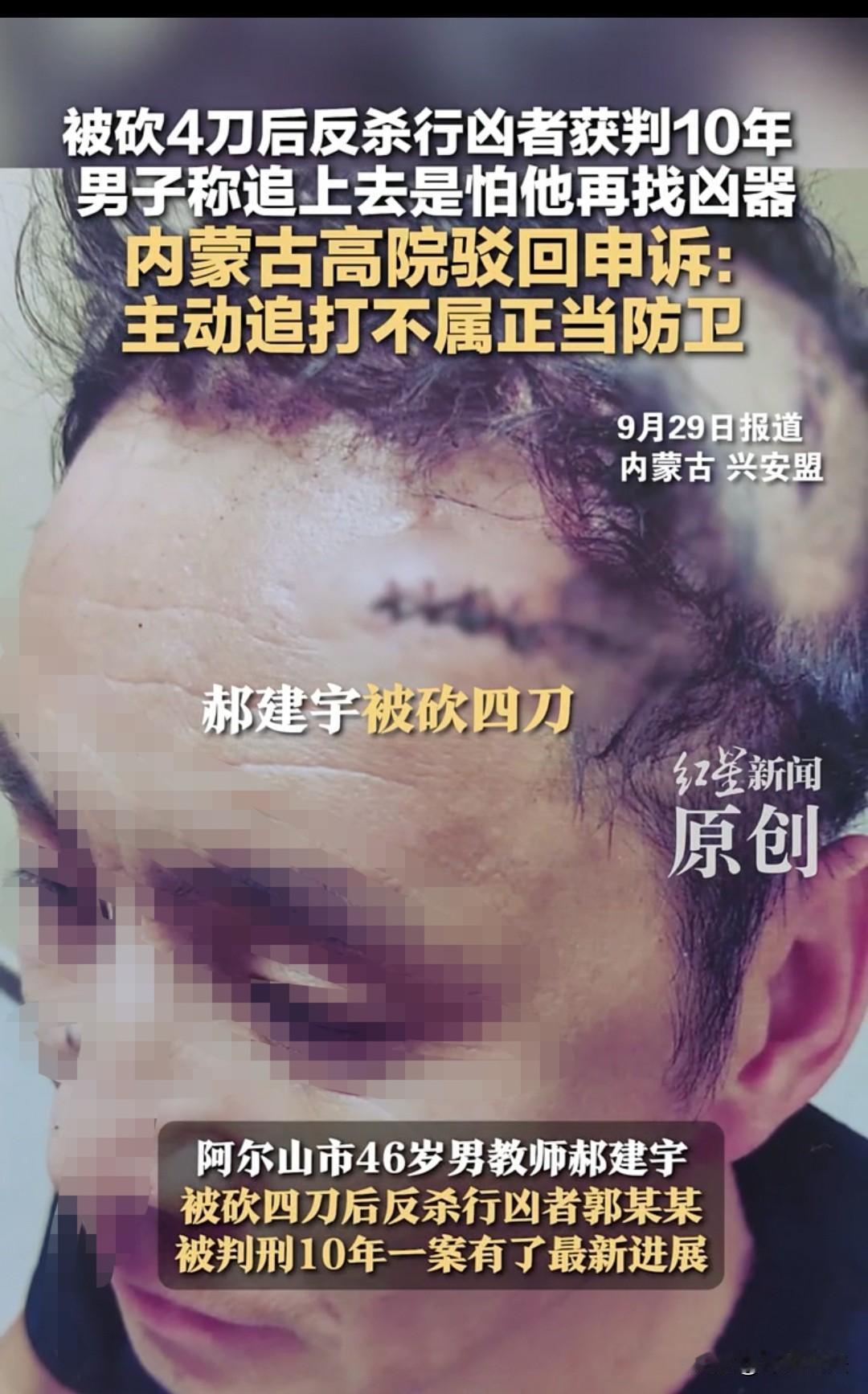 这都不算正当防卫吗？内蒙古，男子和朋友一起回到小区，结果被一个人拿着刀砍了四下。