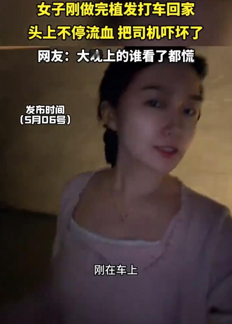 哭笑不得！一女子刚做完植发叫了辆网约车回家，上车后头上就开始流血，女子倒是淡定，