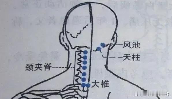 九组针灸法清热，体内所有的热气都可以清除：1玉女方：针补双复溜，泻双内庭。  