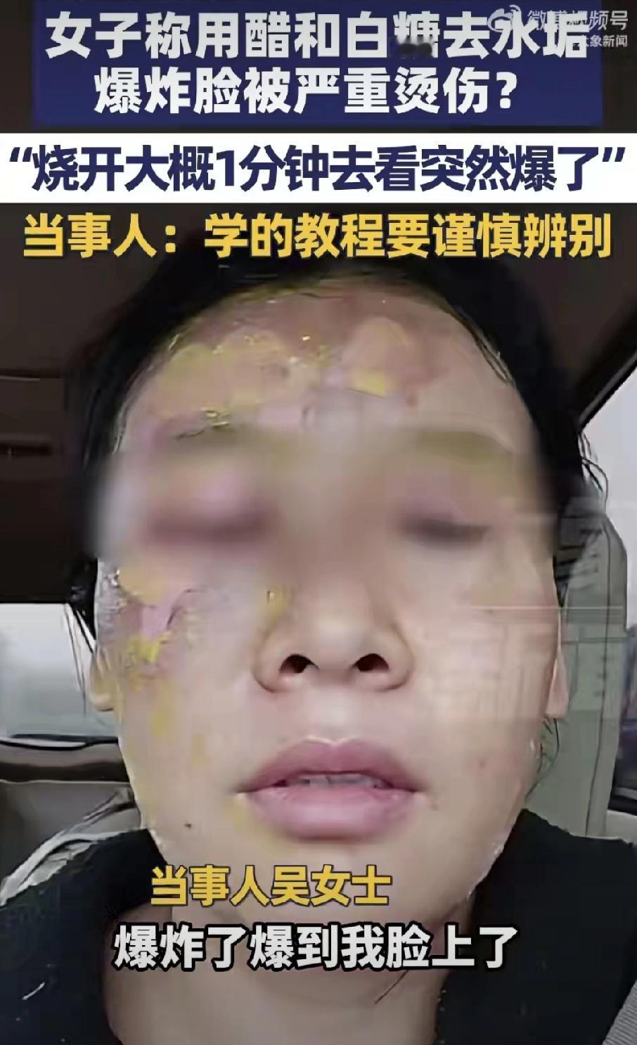 太吓人了！邯郸一位吴大姐学网上小妙招，用白醋加白糖烧开去水垢，没想到刚倒进保温壶