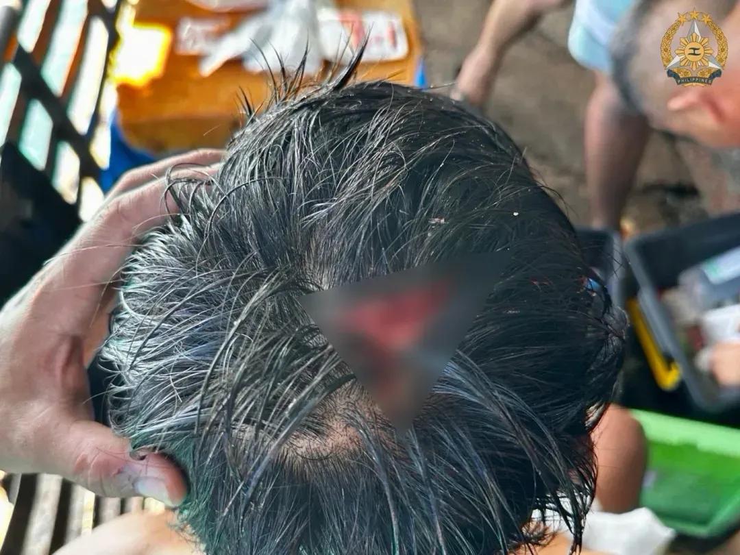赤膊、小艇、几根棍子，冲着中国海警就去了。打了个头破血流，退了，又折返，看见海警