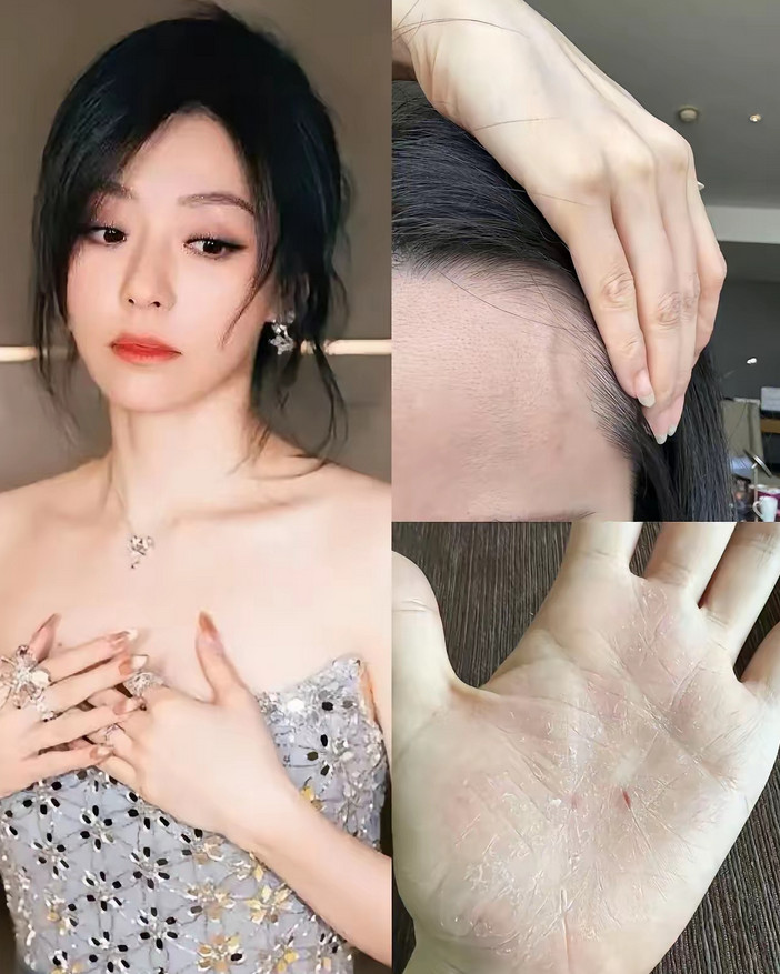对张靓颖来说，往后的日子或许要跟“辣”彻底告别了——倒不是因为吃辣会影响