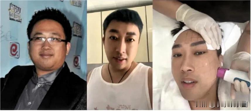 于正这只胖头鱼皮糙肉厚上熨斗，据说从1...3花了一百多万！植发30万，纹眉一万