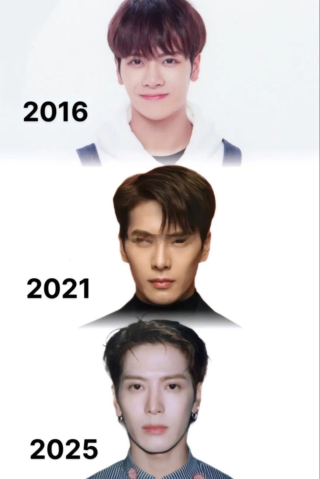 王嘉尔自曝做艺人确实要做医美，只是别人不公开，不公开说而已。每年都有啊，你妹有医