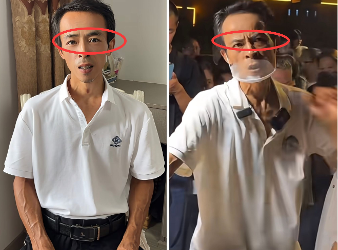鸡排哥的面相，完全变了。之前的他：6元鸡排，60元情绪价值。现在的他：哪