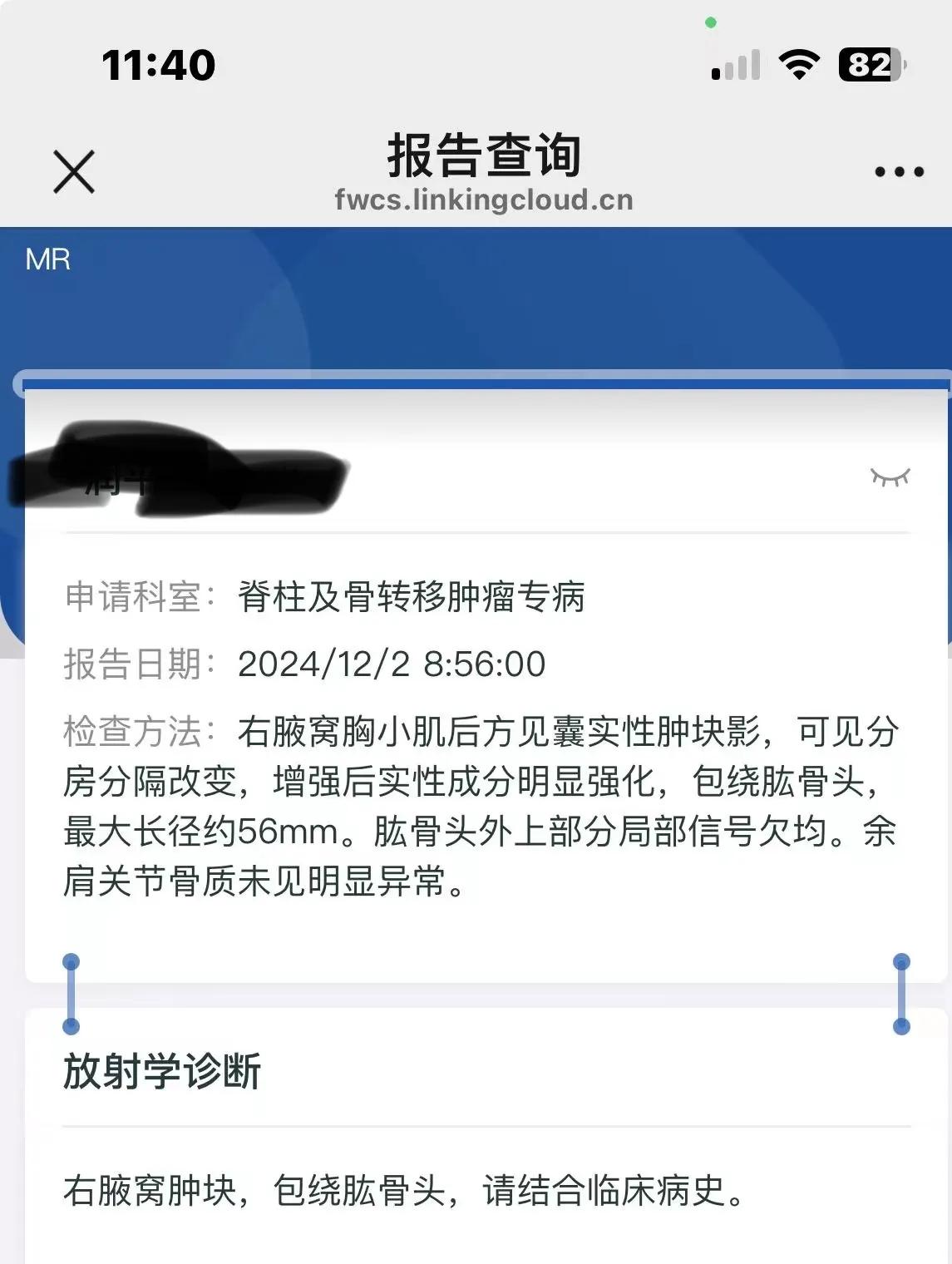 前一段身体出了点问题，就频繁的做CT做核赫，几天之内做了两个CT，两个增强核赫，