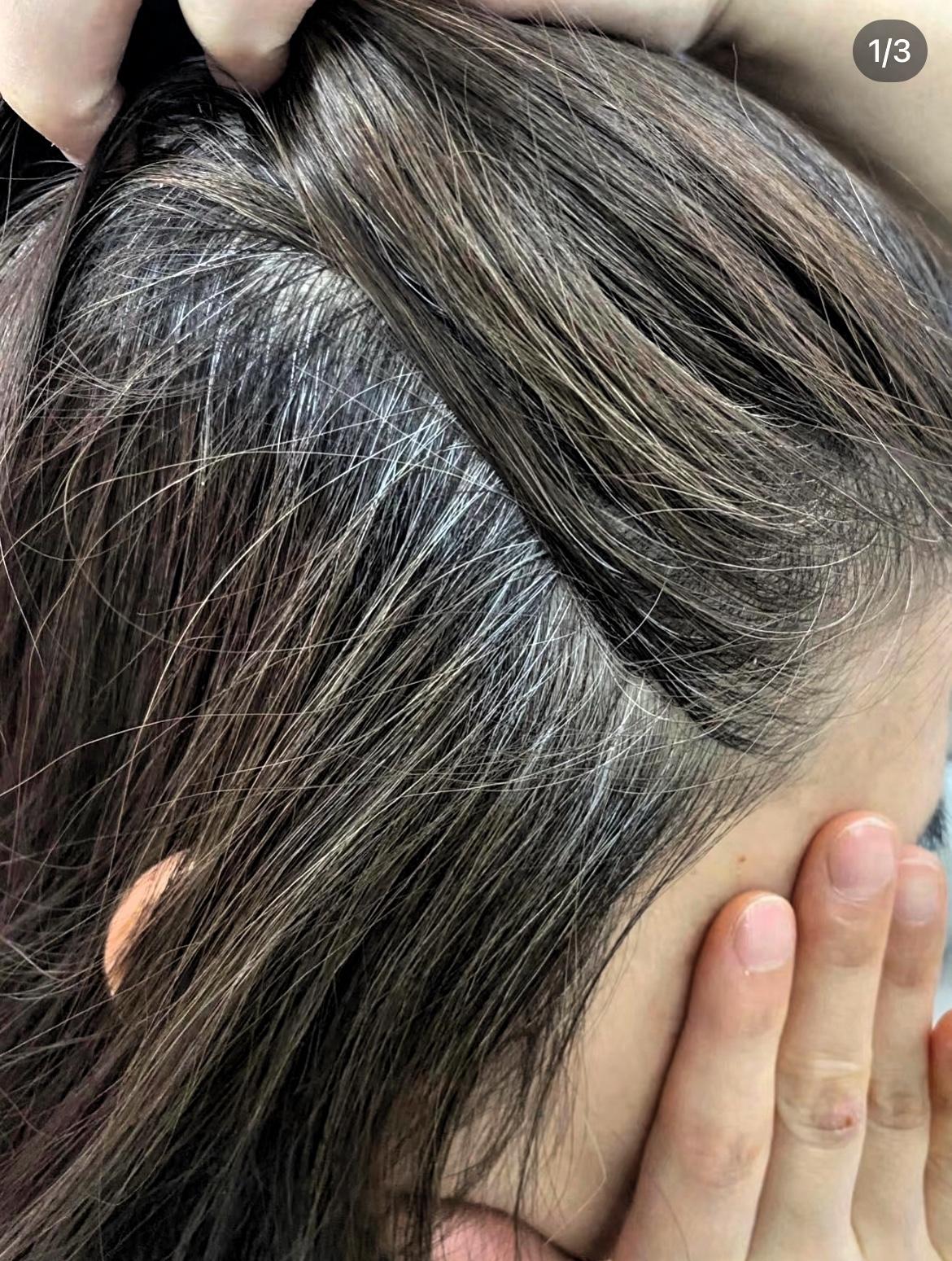 一个老中医跟我说，你应该庆幸自己长了白头发。前几天跟老中医聊天，他盯着我头顶