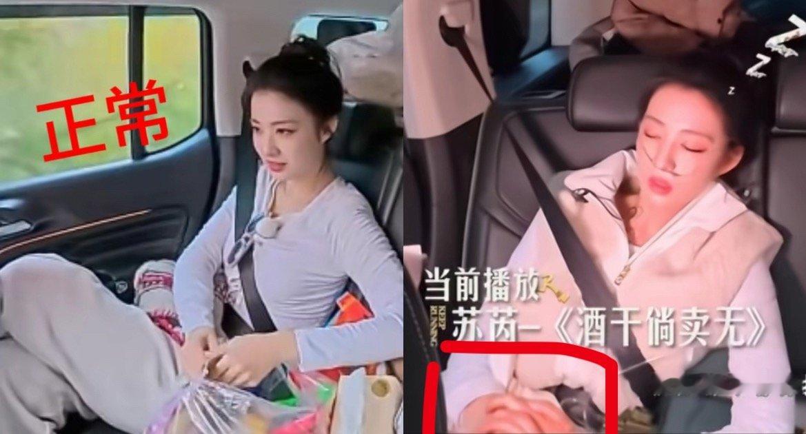 王楚然高反手都肿了王楚然因为高反四肢都水肿了，这个手看起来非常明显，这个程度都是
