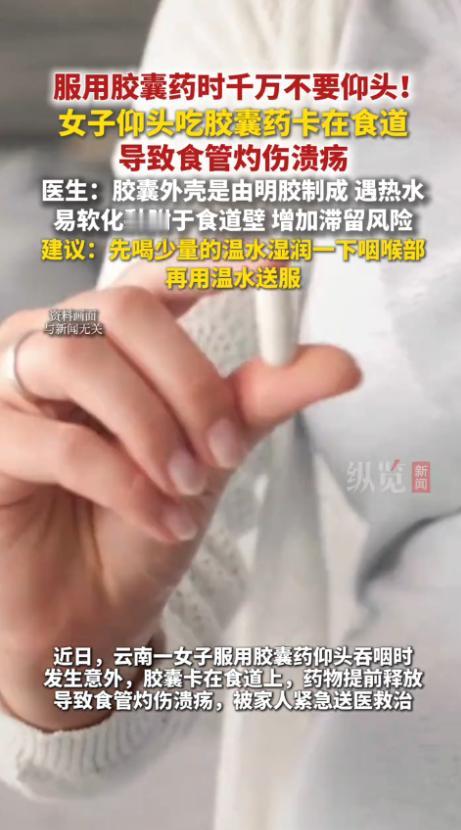 悲剧还是发生了！云南，一女子生病吃胶囊，仰头吞咽时，胶囊却卡在了食道内，本应在胃