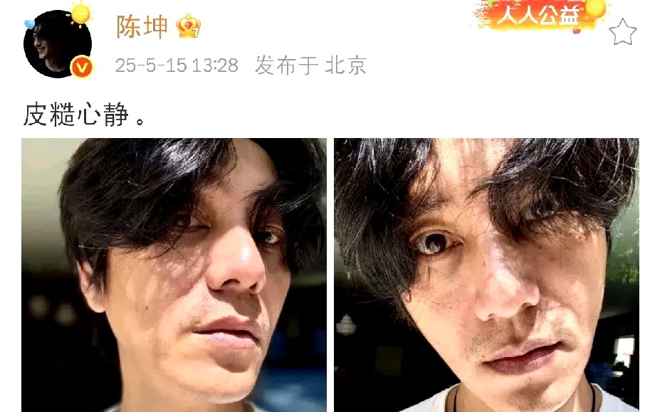 陈坤这波操作太圈粉了！别的明星都在拼命磨皮美白，他直接甩出高清素颜照，连法令纹和