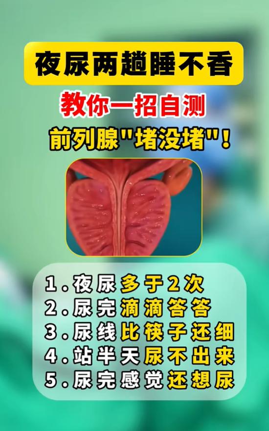 尿线细、尿不尽，5个信号提示前列腺可能增生