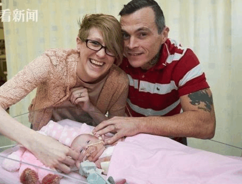 坚强! 女婴心脏长在体外奇迹存活! 孕前检查很重要!