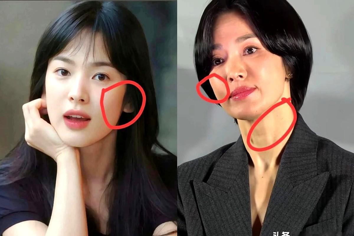 宋慧乔近照一出，全网都在说她老了。最近活动上的她，确实和《浪漫满屋》那会儿没