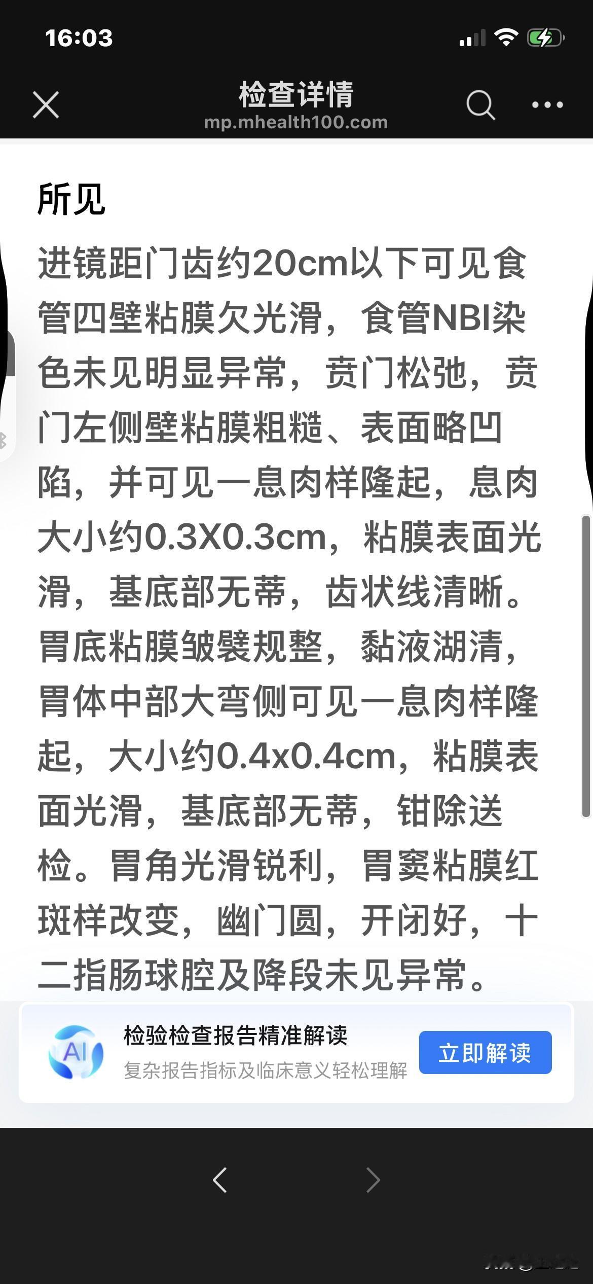 我的胃肠镜经历，从鬼门关过一回，需要做的可以往下看。前年做过无痛肠镜，这次是