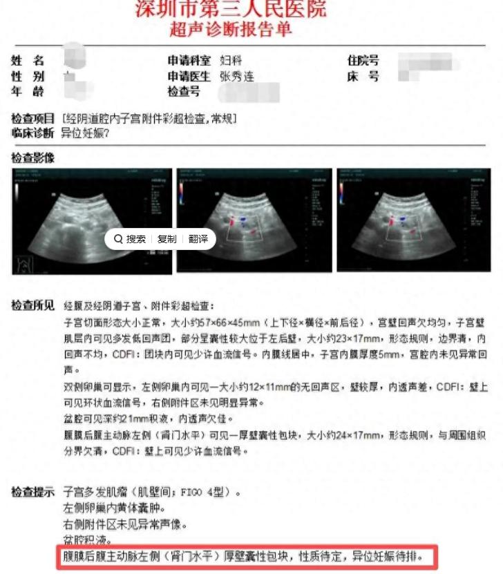 女子怀孕照B超找不到“宝宝”？2026年5月，深圳32岁的王女士拿着阳