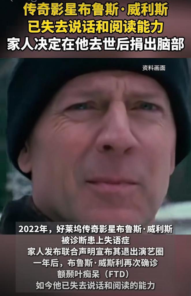 银幕硬汉的终极担当！布鲁斯捐脑之举，看哭无数人好莱坞巨星布鲁斯·威利斯要捐