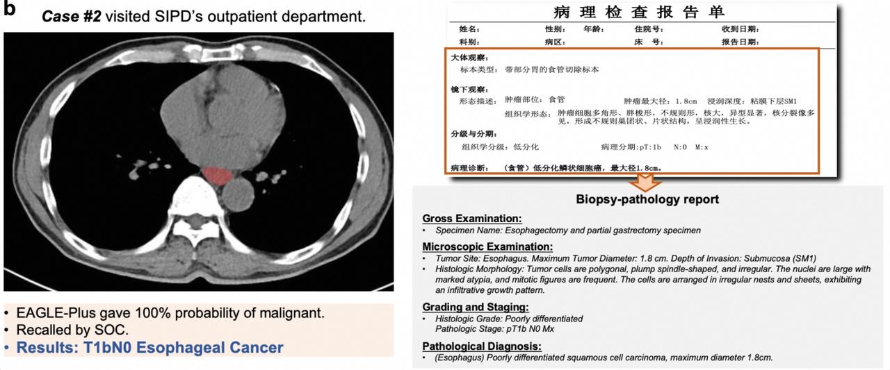 谁能想到，素来逢中必反的《纽约时报》，居然拿出整版篇幅正面报道中国？更让美国