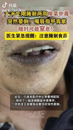 太吓人了！5月12日，浙江宁波，一老人吃了腌制两周的榨菜，结果当吃完饭去外面散步