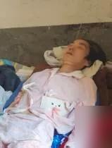 我49岁频繁眩晕，跑断腿查不出病因，换个科室一查，才知道是这毛病。说真的这俩