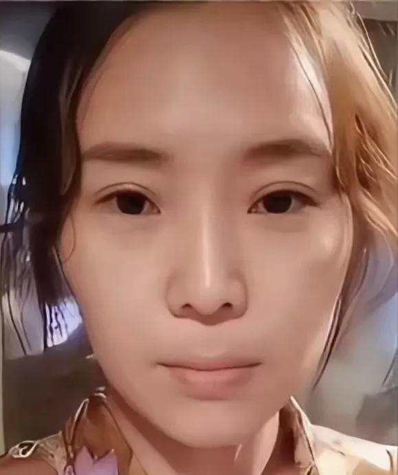 云朵声带受损真的使用了玻尿酸？网上传言歌手云朵为了美容，使用了玻尿酸，导致声