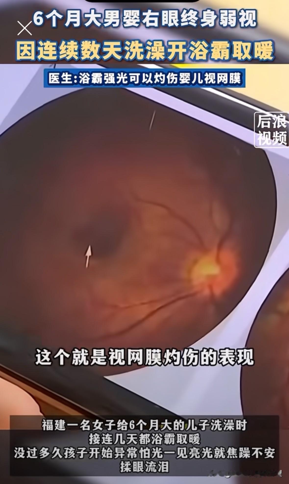 “令人痛心”！福建，一名六个月大的婴儿洗澡时，连续几天妈妈都开着浴霸取暖。没过多