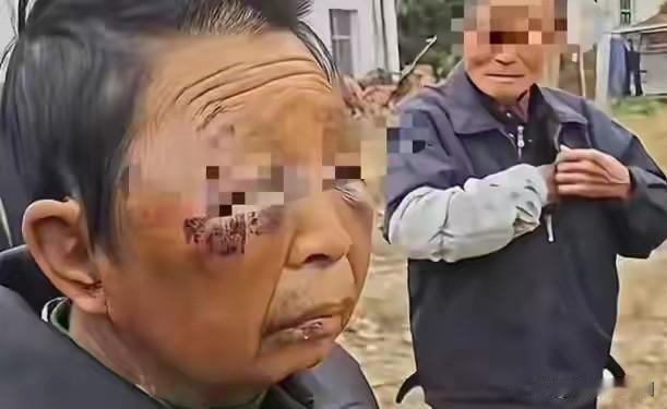 湖南女子被丈夫打到脸部变形，经过再次走访调查，发现事情远比想象中复杂，1、