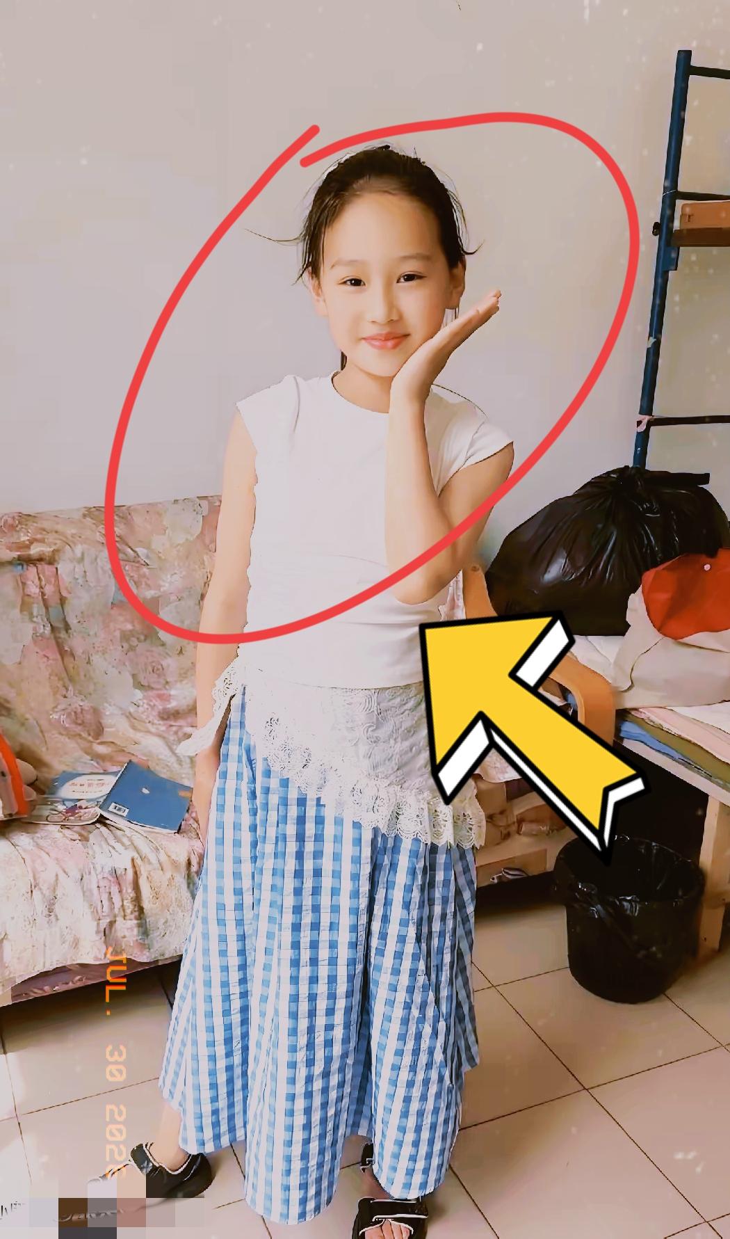 真的不敢相信！就无意间蹭了孩子胳膊一下！竟查出11岁女儿终身相伴的1型糖尿病！