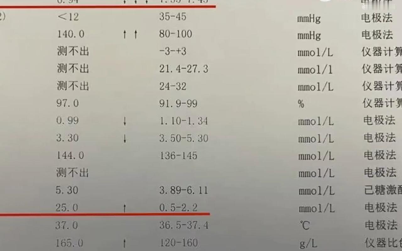 34岁男子每天喝1斤白酒致酸中毒：乳酸值高达25mmol/L，一般乳酸值超过10