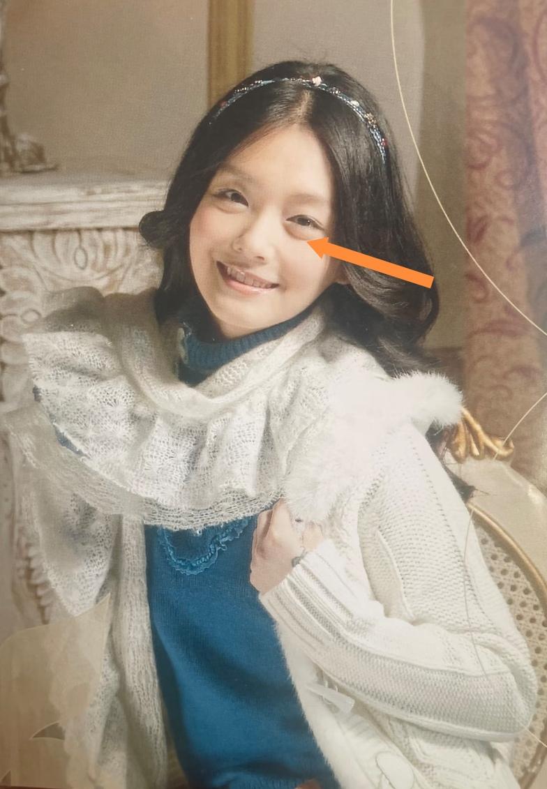 看大S这张早期的照片，真的没想到她的卧蚕这么明显，大得都快跟眼袋一样了。可就算这