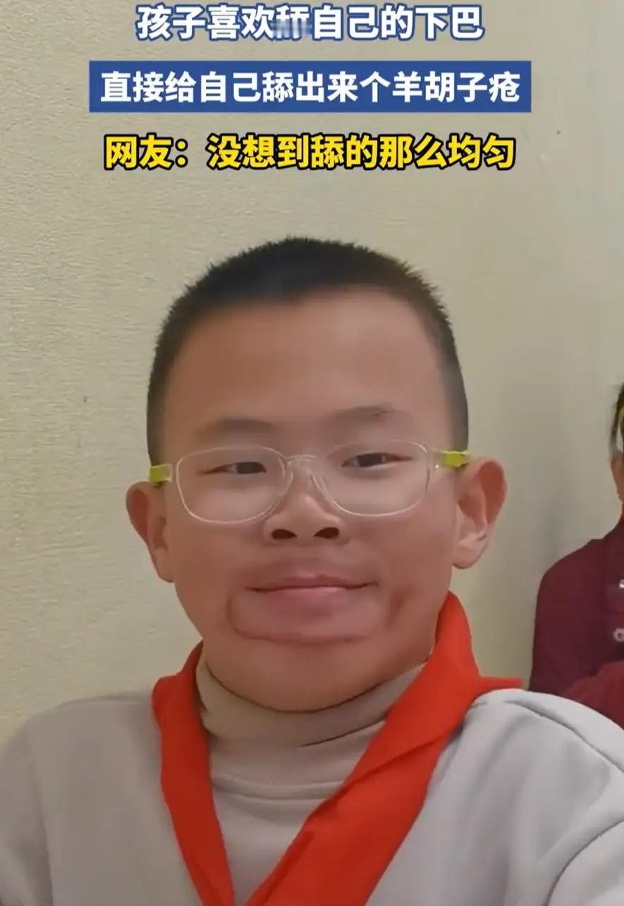 “这还能笑得出来？”浙江，一名男孩有个不太好的习惯，就是孩子喜欢舔自己的下巴，可