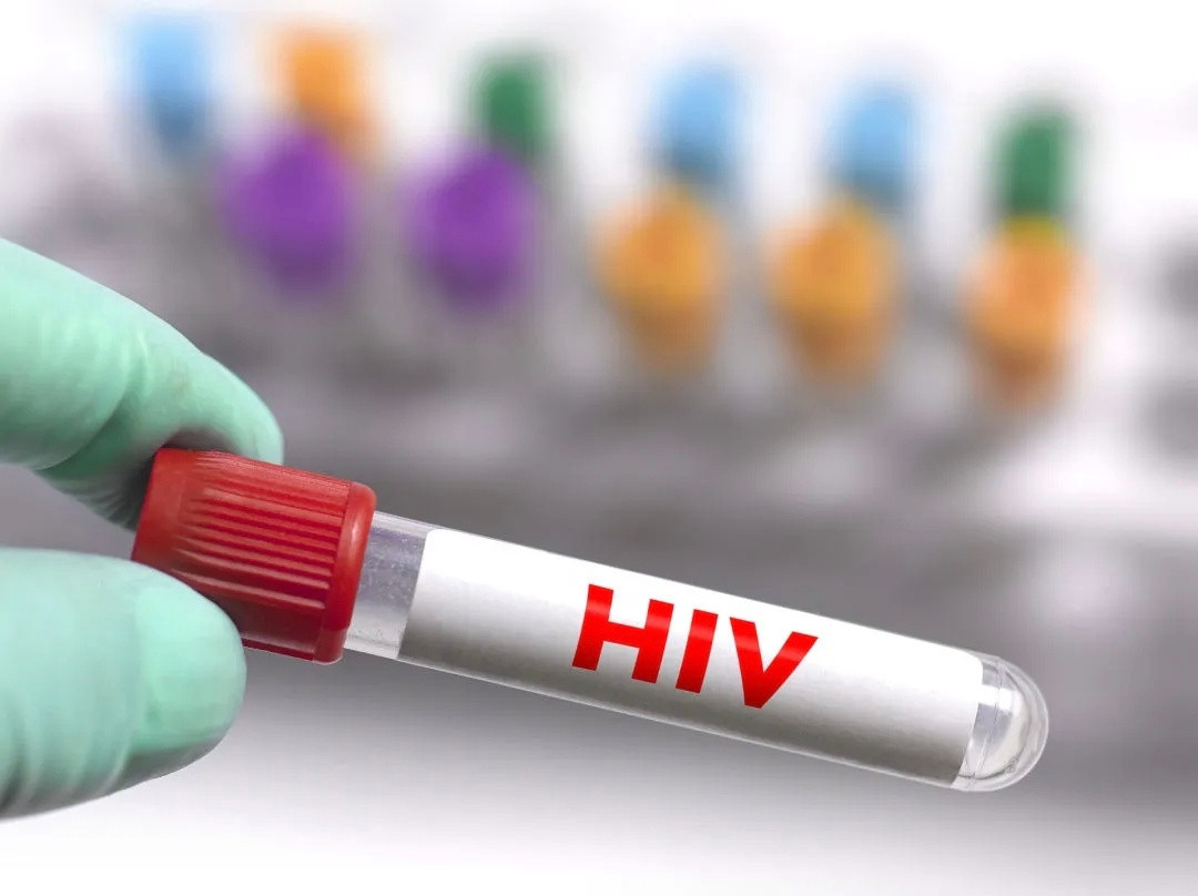 艾滋病隐私1980年代美国强制报告HIV感染者信息，导致：检测率下降40%高危